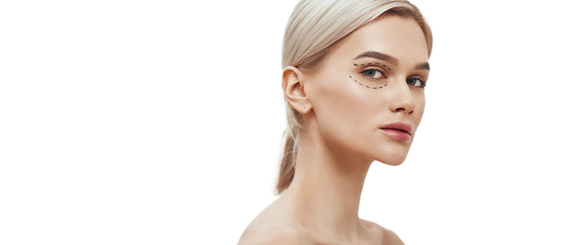 Imagem Blefaroplastia
